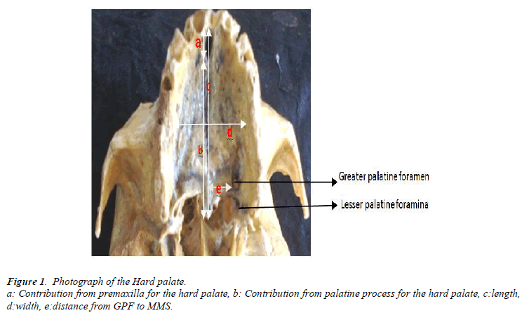 biomedres-Photograph-Hard-palate