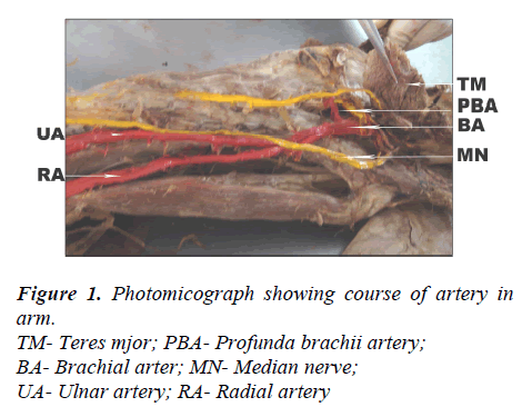 biomedres-Photomicograph-course-artery