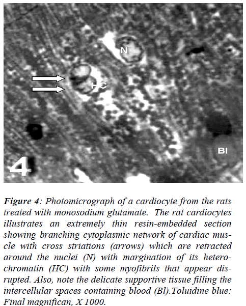 biomedres-Photomicrograph-cardiocyte-cytoplasmic