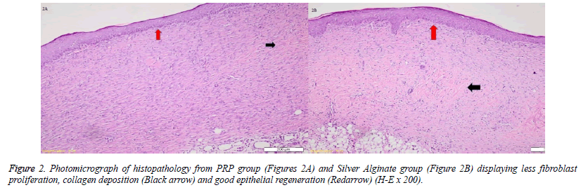 Photomicrograph-histopathology-epithelial