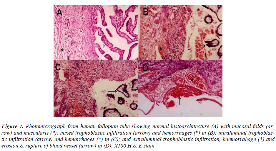 biomedres-Photomicrograph-human-fallopian