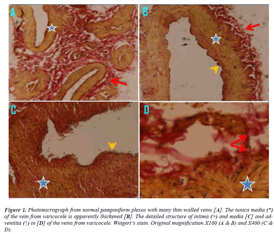 biomedres-Photomicrograph-normal-pampiniform