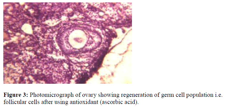 biomedres-Photomicrograph-ovary-regeneration-germ-cell