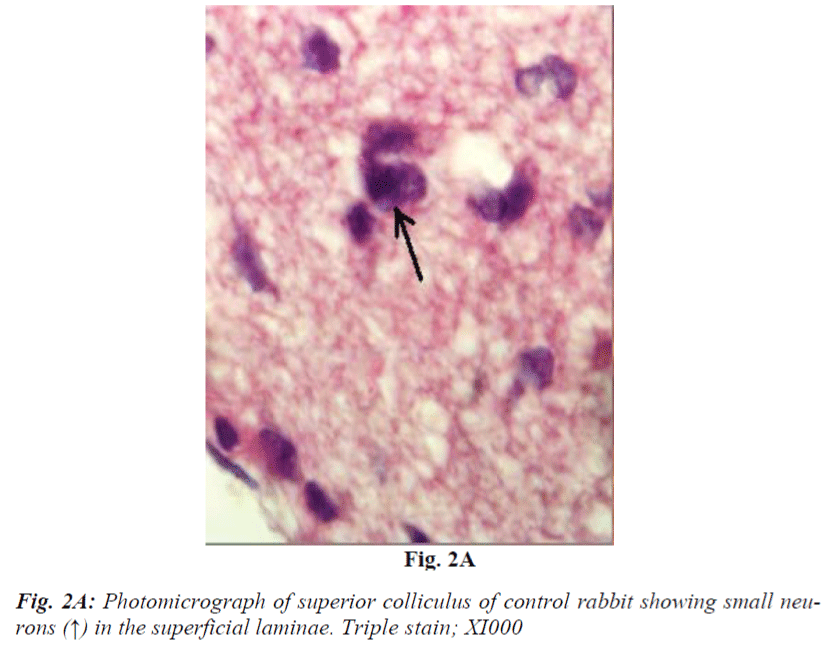 biomedres-Photomicrograph-superior-colliculus