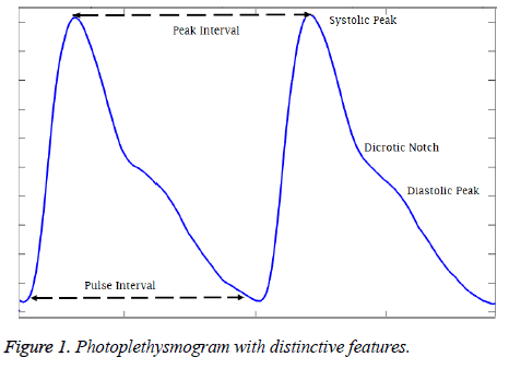 biomedres-Photoplethysmogram