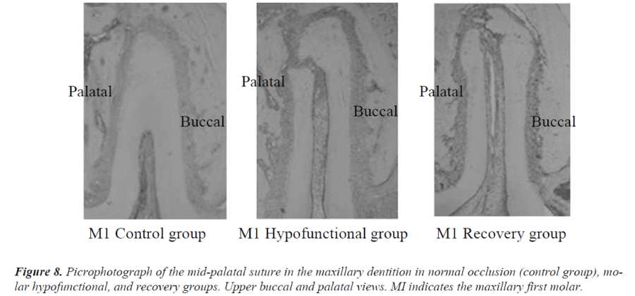 biomedres-Picrophotograph-mid-palatal-suture