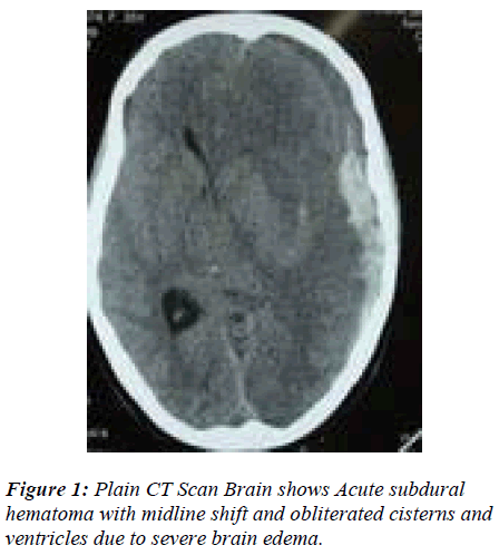 biomedres-Plain-CT-Scan-Brain