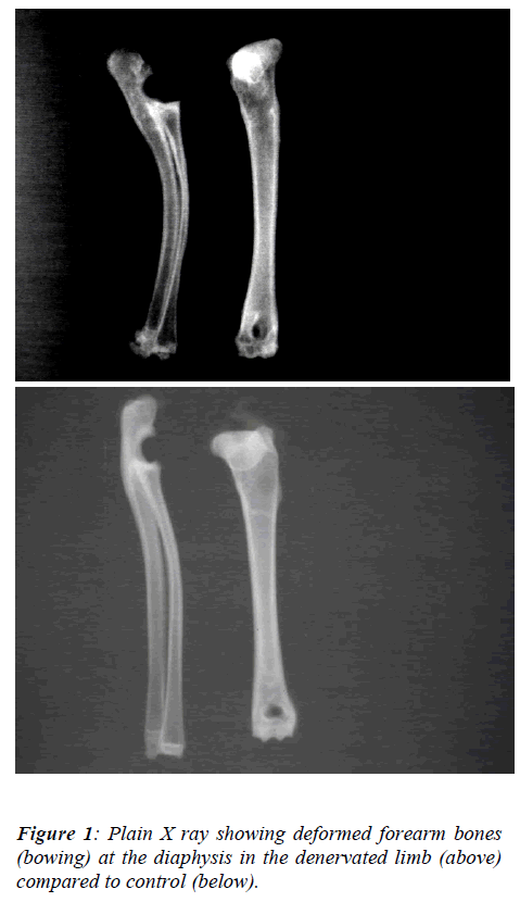 biomedres-Plain-X-ray-showing-deformed