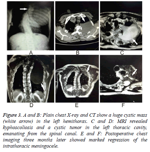 biomedres-Plain-chest