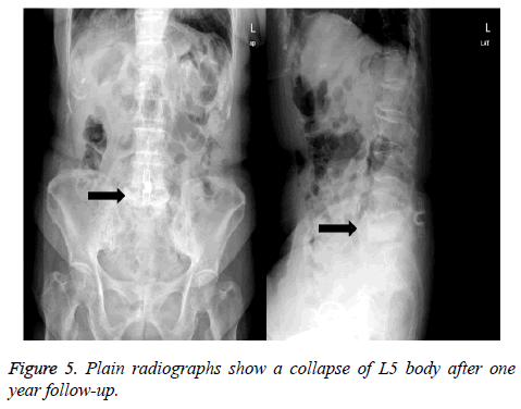 biomedres-Plain-radiographs