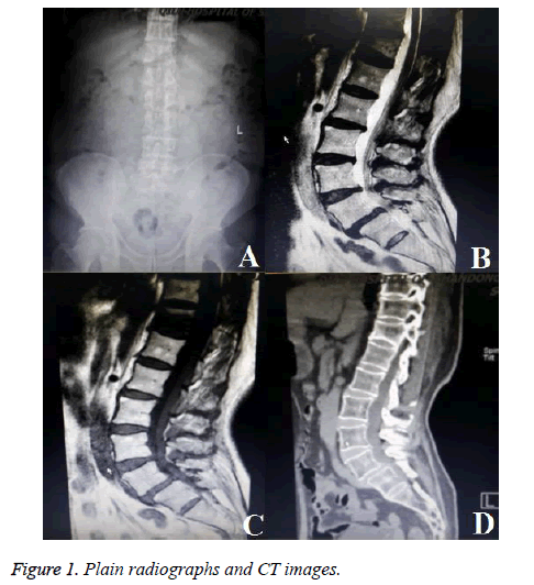 biomedres-Plain-radiographs