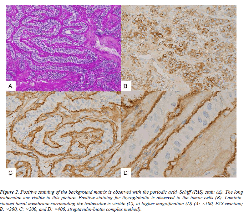 biomedres-Positive-staining-background-matrix