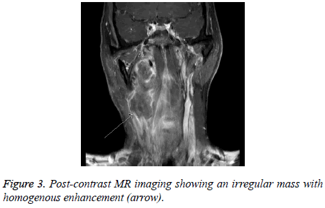 biomedres-Post-contrast