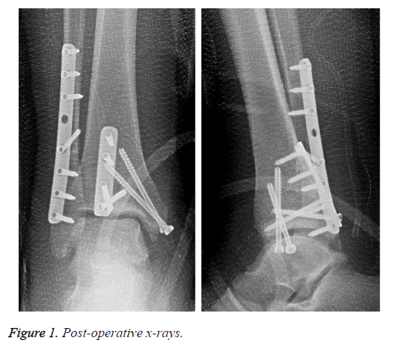 biomedres-Post-operative