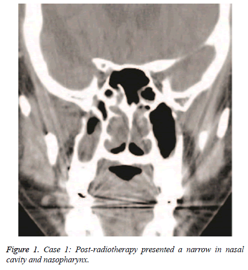 biomedres-Post-radiotherapy