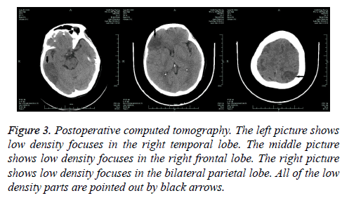 biomedres-Postoperative-computed