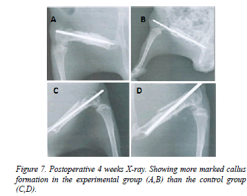 biomedres-Postoperative-weeks-callus