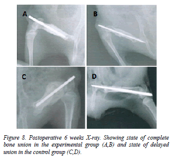 biomedres-Postoperative-weeks-callus