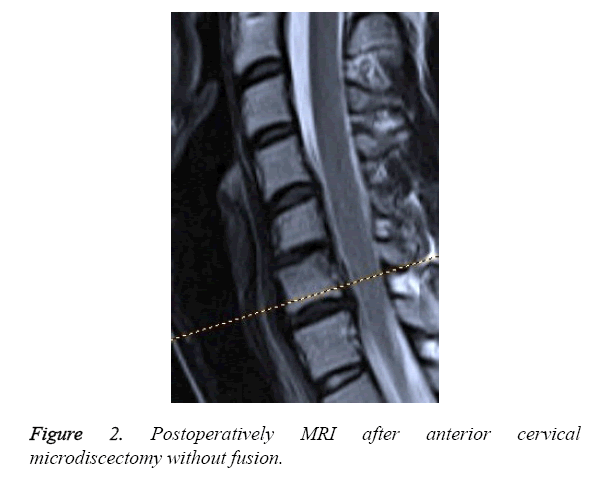 biomedres-Postoperatively-MRI