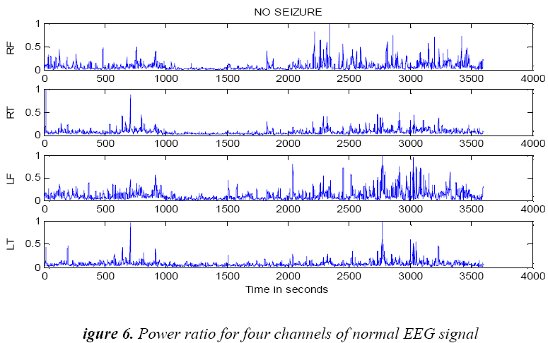 biomedres-Power-ratio-four-channels