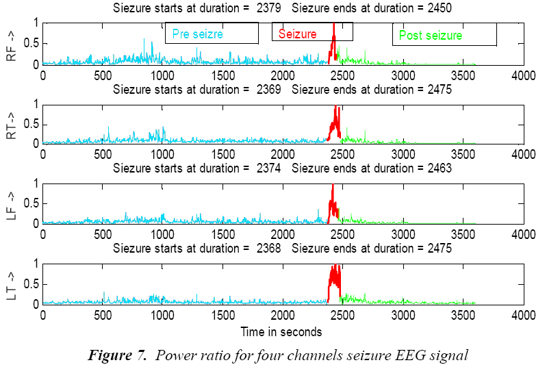 biomedres-Power-seizure-EEG-signal