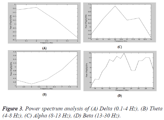 biomedres-Power-spectrum-analysis