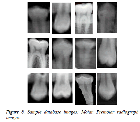 biomedres-Premolar-radiograph