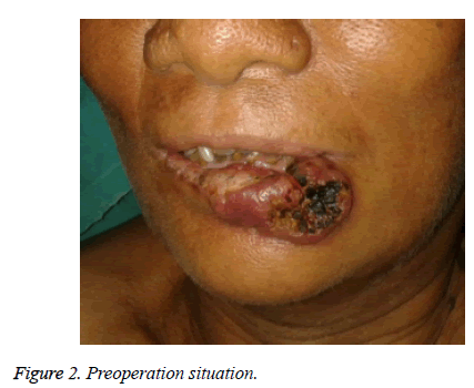 biomedres-Preoperation-situation