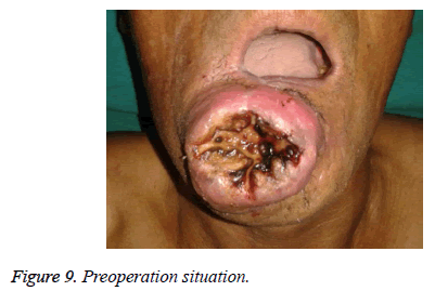 biomedres-Preoperation-situation