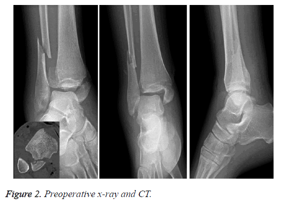 biomedres-Preoperative