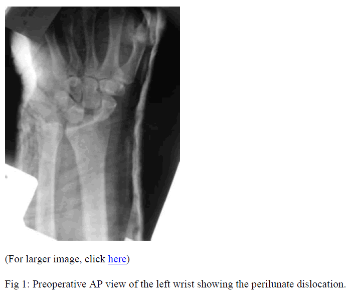 biomedres-Preoperative-AP-view