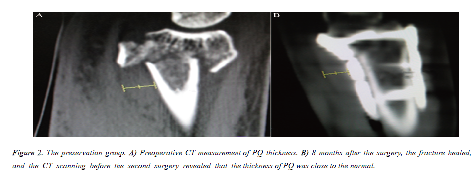 biomedres-Preoperative-CT-measurement