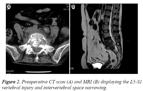 biomedres-Preoperative-CT-scan