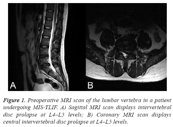 biomedres-Preoperative-MRI-scan