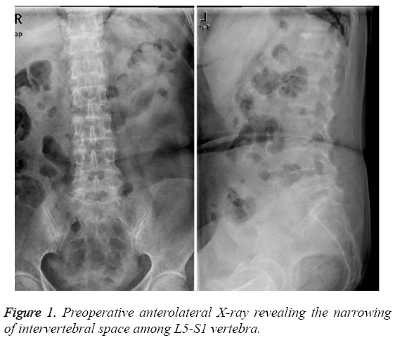 biomedres-Preoperative-anterolateral