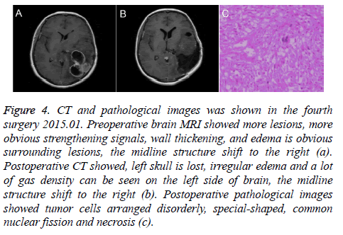 biomedres-Preoperative-brain