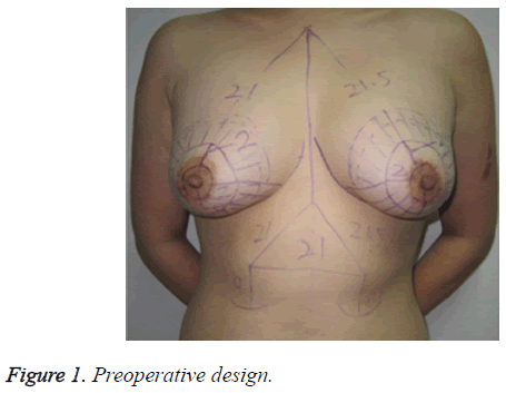 biomedres-Preoperative-design