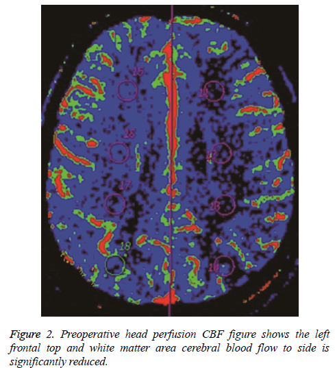 biomedres-Preoperative-head