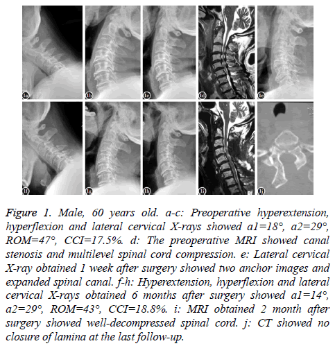 biomedres-Preoperative-hyperextension