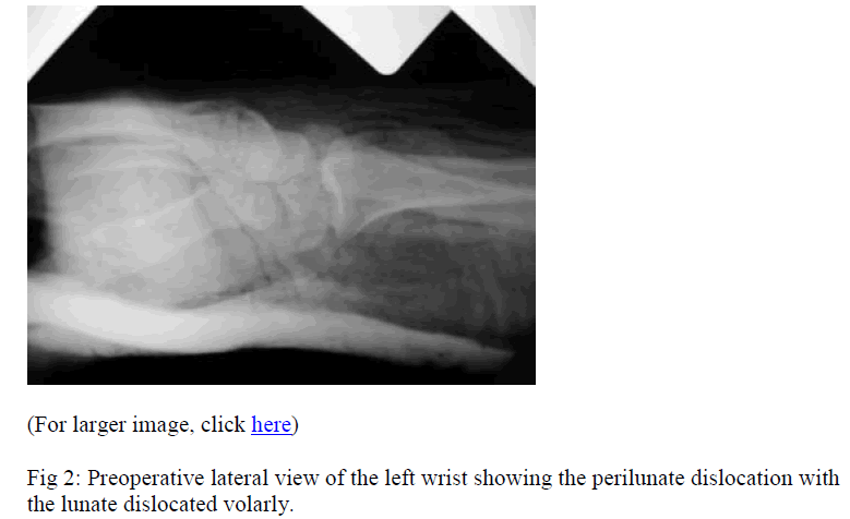 biomedres-Preoperative-lateral-view