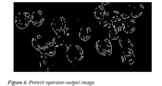 biomedres-Prewitt-operator