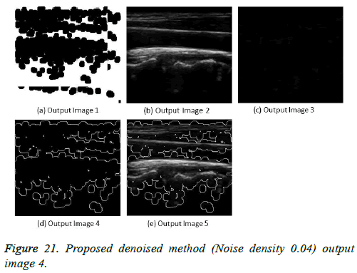 biomedres-Proposed-denoised