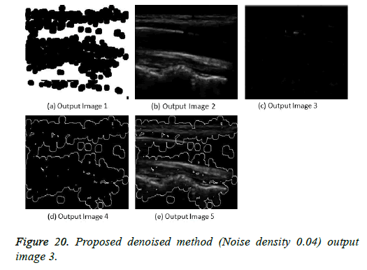 biomedres-Proposed-denoised