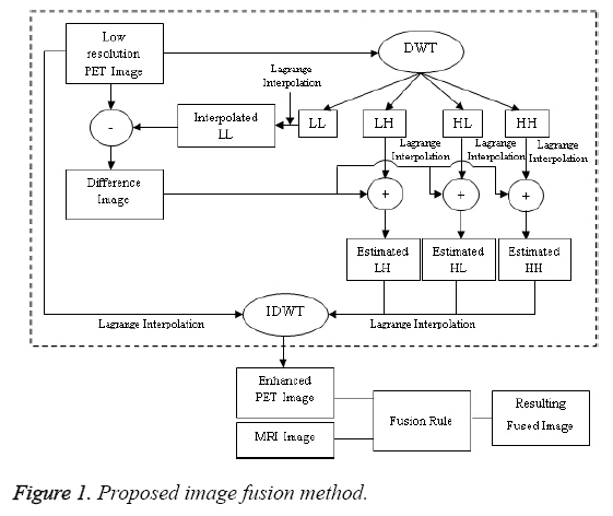 biomedres-Proposed-image-fusion