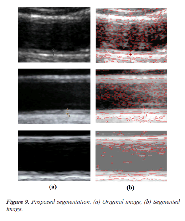 biomedres-Proposed-segmentation