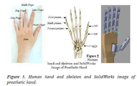 biomedres-Prosthetic-hand