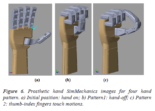 biomedres-Prosthetic-hand