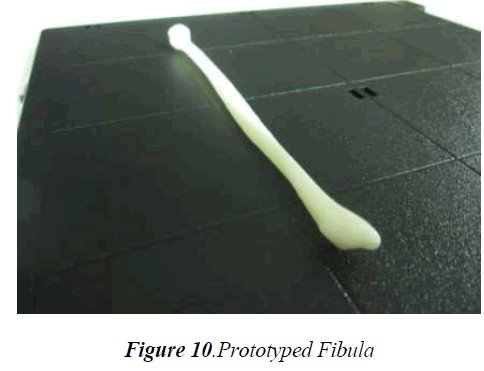 biomedres-Prototyped-Fibula