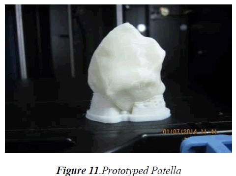 biomedres-Prototyped-Patella