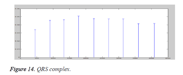 biomedres-QRS-complex